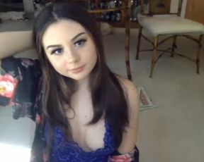 SidBaby braces 1st day 08092017